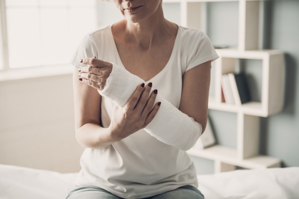 woman with an injured arm